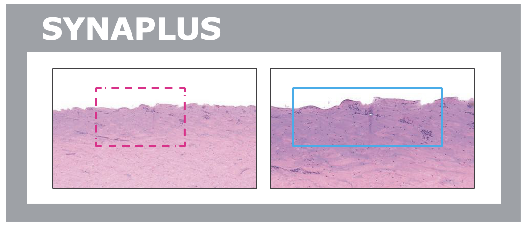 Synaplus 導入精華毋須創傷皮膚表層